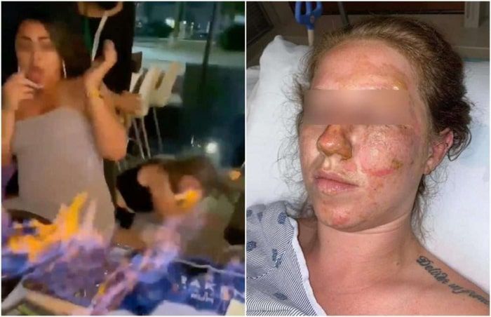 Cancun waiter burns tourist when he flambéed a birthday drink